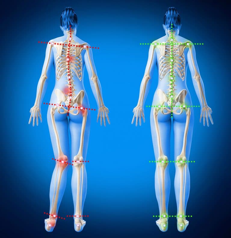 semelles-orthopediques orthopiana-min